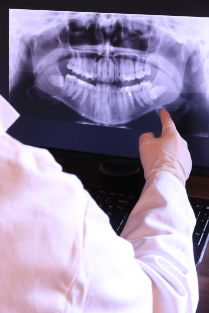 Best Dental Abscess Treatment in Plano, KY