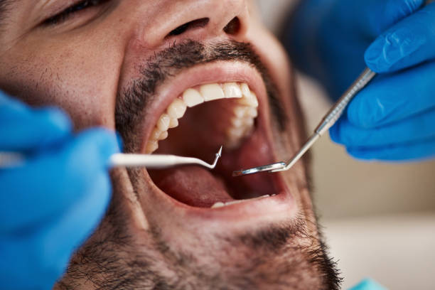 Best Emergency Treatment for Oral Infections in Plano, KY